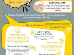 Common Signs You Need to Get Wisdom Teeth Removed