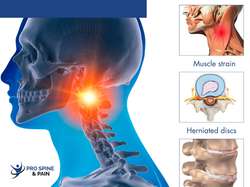 neck-pain